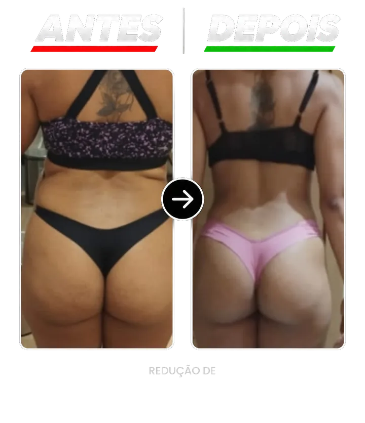 Resultado de aluno: antes e depois